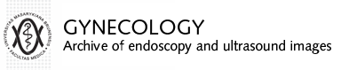Gynecology: Archive of endoscopy and ultrasound images