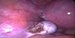 Uterus with coagulated left uterine horn after salpingectomy - removal of the left uterine tube, left  in left intact / Děloha se zkoagulovaným levým rohem děložním, odstraněným levým vejcovodem, levé ovarium je ponecháno intaktní.