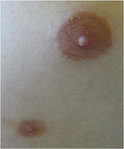 Figure 12: Accessory nipple (KDO FN Brno)