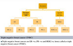 Figure 18: Receptor overexpression specific for breast cancer (Jadhav A, 2013)