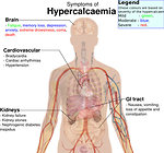 Figure 5: Clinical symptoms of hypercalcemia