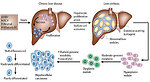 Figure 5: Pathogenesis of hepatocellular carcinoma