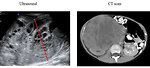 Figure 10: Radiology  - UZ and CT