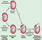 Figure 17: The role of genetic and epigenetic changes in tumorigenesis of Wilms tumor