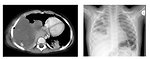 Figure 3: CT scans