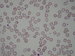 hypochromic red blood cells, some of them even look like anulocytes / hypochromn erytrocyty, nkter z nich a anulocyty