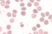 Plasmodium vivax causes benign tertian malaria. Erythrocytes are enlarged, in some of them Schffner dots are present.
 / Plasmodium vivax je pvodcem benign tdenn horeky. Napaden krvinka se zvtuje a asto obsahuje Schfnerovo tekovn.
