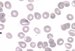Plasmodium vivax causes benign tertian malaria. Erythrocytes are enlarged, in some of them Schffner dots are present.
 / Plasmodium vivax je pvodcem benign tdenn horeky. Napaden krvinka se zvtuje a asto obsahuje Schfnerovo tekovn.