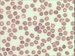 Plasmodium vivax causes benign tertian malaria. Erythrocytes are enlarged, in some of them Schffner dots are present. At the centre of the picture gametocyte is present.
 / Plasmodium vivax je pvodcem benign tdenn horeky. Napaden krvinka se zvtuje, asto je ovln na okrajch s vbky a asto obsahuje Schfnerovo tekovn. Gametocyt uprosted.