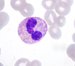 In  the middle of a  neutrophilic granulocyte you can see  a paranuclear blue inclusion body among the neutrophilic granules, morphologicaly corresponding to Doehle body, typical for MHA granulocytes. / V neutrofilnm granulocytu uprosted obrzku vidme mezi neutrofilnmi granuly paranuklern vpravo svtlemodr inklusn tlsko, morfologicky odpovdajc Doehleho inklusm, kter je typick pro neutrofiln granulocyty u MHA.