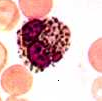 granulocyty eosinofilní