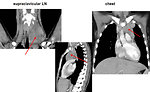 Figure 7: CT scan