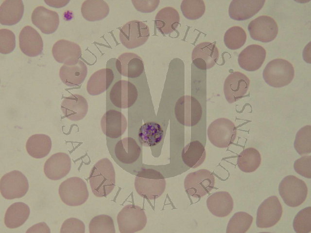 Plasmodium malariae (malaria quartana)