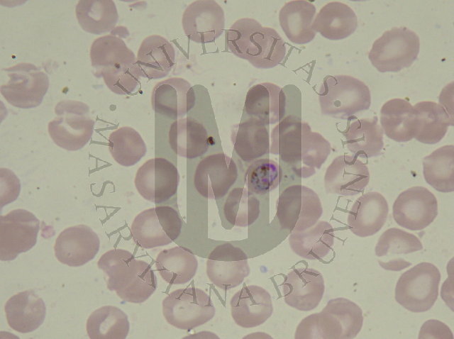 Plasmodium malariae (malaria qartana)