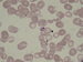 The makrogametocyte (female gametocyte) filles all the erytrocyte. / Makrogametocyt (sami gametocyt) vyplujc cel erytrocyt.  